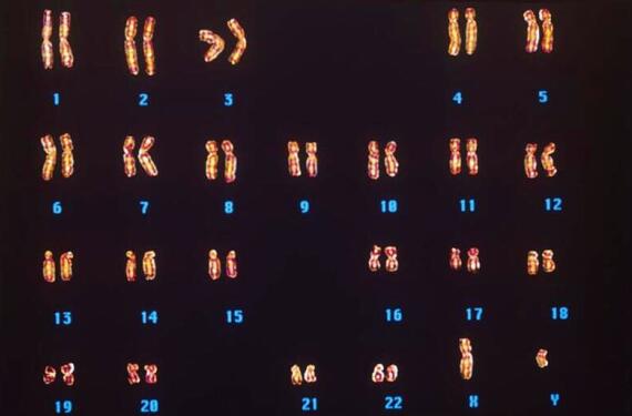 怎样备孕!染色体x男y女"勇往直前"-第2张图片-天光博客