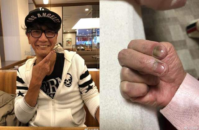 61岁日本男星加藤鹰晒近照金手指萎缩发黑网友喊话期待新作