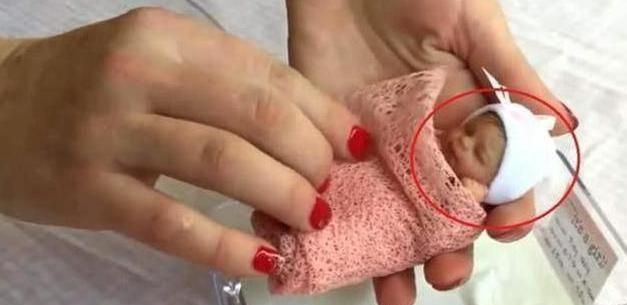 14年前,整个身体还不是巴掌大"小婴儿",现在是什么样子?