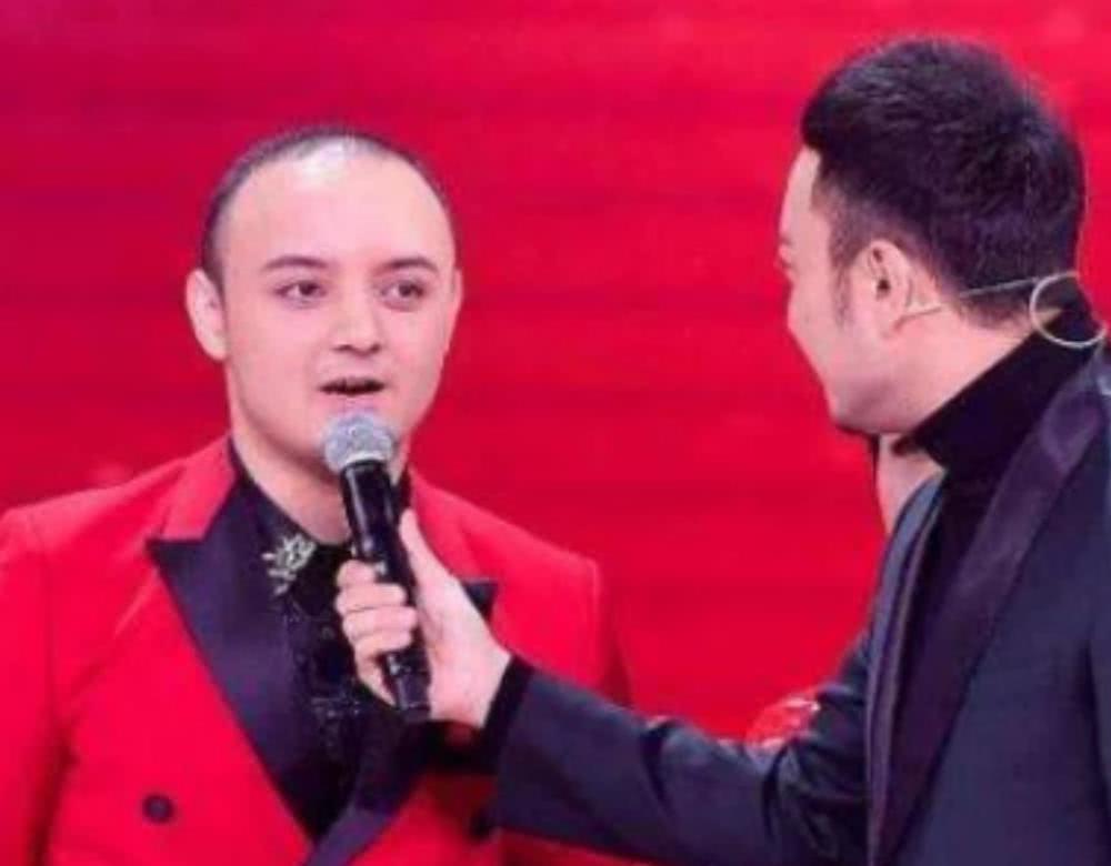 童星阿尔法"变脸式"长大,曾因秃顶众人嘲,如今帅成混血超模脸