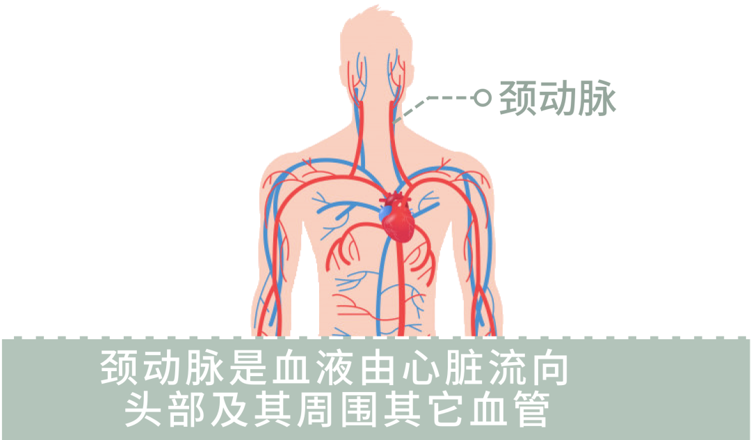 宋慧医生查出颈动脉斑块拿什么才能拯救自己