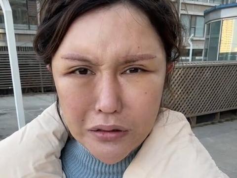 网红美娜分享近百次整容经历花了这么多钱还是这熊样