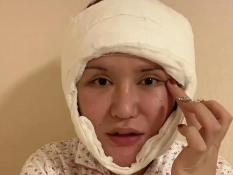 网红美娜分享近百次整容经历花了这么多钱还是这熊样