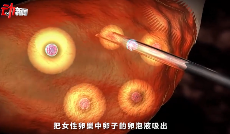 "兼职,2到8万":别让卖卵黑产"入侵"大学校园|卵子|兼职|代孕_新浪新闻