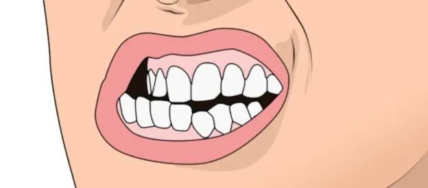 磨牙的孩子是因为肚子里有寄生虫这个问题老外也在纠结