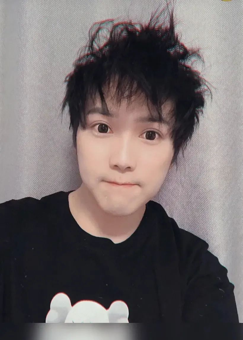 还记得靠苏喂苏喂出圈的网红大皇子吗他秃成这样了