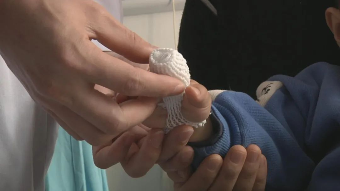 一岁半男童佑佑(化名)的右手食指包裹着厚纱布