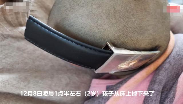 揪心！2岁女童从床上跌落，被皮带扣深深插进后脑，家长需警惕休闲区蓝鸢梦想 - Www.slyday.coM