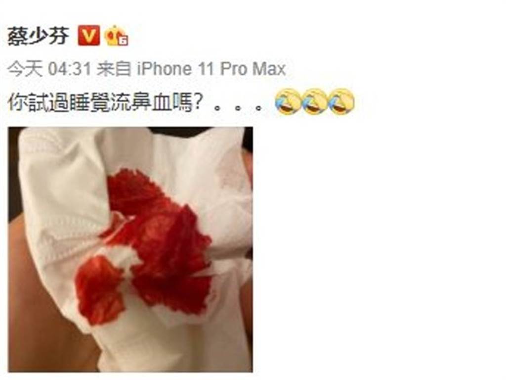蔡少芬深夜流大量鼻血一片鲜血吓坏网友黎姿留言送关心