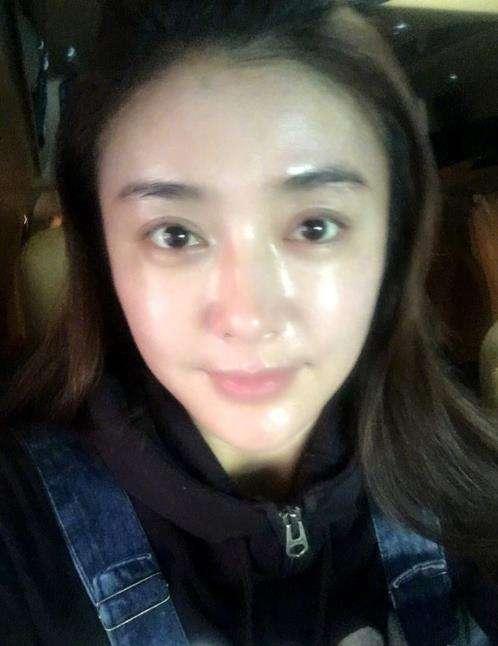 打脸娱乐圈|秦岚|皇后|痘痘_新浪新闻