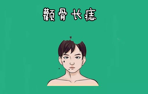 男人身上四颗克妻痣克妻财运损妻事业能点掉吗