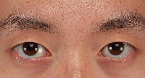 不是每个男人都适合当老公,哪种面相的男人不能要|面相|三白眼|眉毛