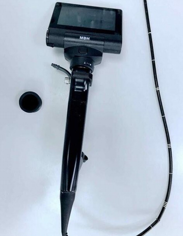 真·如鲠在喉!济一2个月小孩嗓子里长了巨大肿瘤