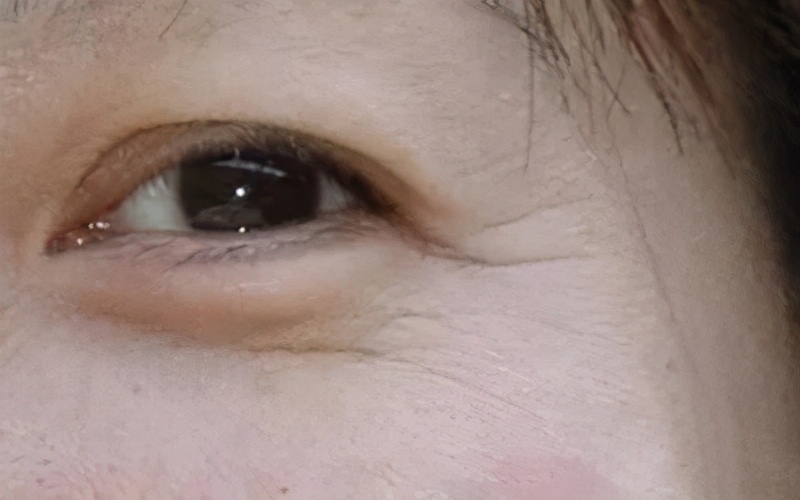 救救眼纹吧!别再让眼睛出卖你的年龄|眼纹|眼霜|细纹_新浪新闻