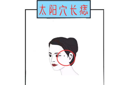 太阳穴长痣太阳穴是人眼尾到发际线的位置,在面相学中也被称为"奸门"