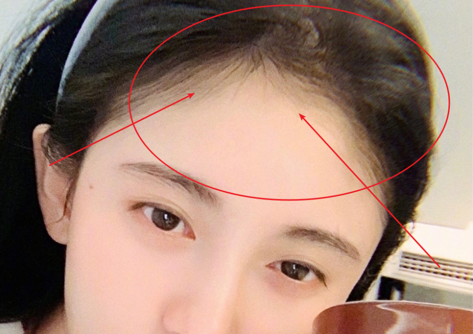 鞠婧祎罕见晒素颜照,胎毛媲美白鹿,这发际线终于"实锤"了!