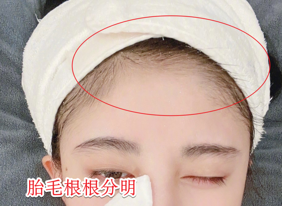 鞠婧祎罕见晒素颜照,胎毛媲美白鹿,这发际线终于"实锤"了!