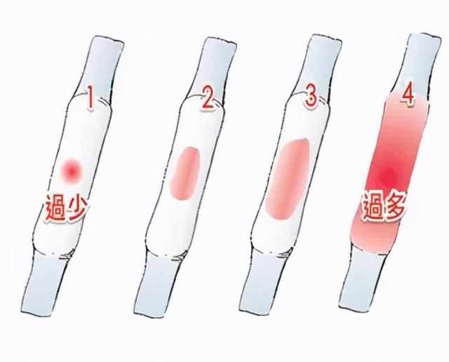 80ml 为月经过多.