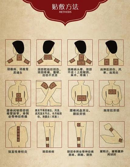 岱岳区妇幼保健院中医孙慧玲:冬季养生莫错过,三九敷贴防未病