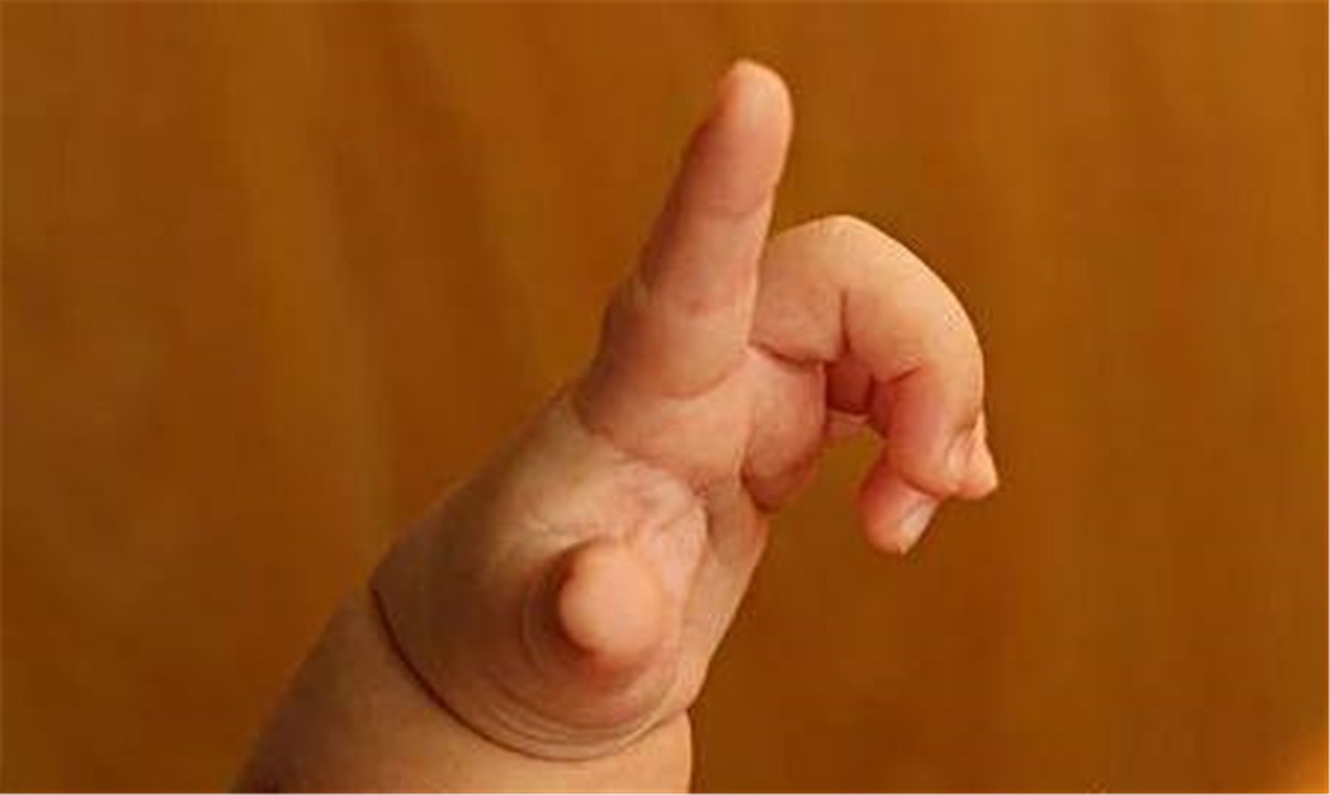 为啥宝宝总爱"打脸"?其实是"手部敏感期"到了,父母别误会