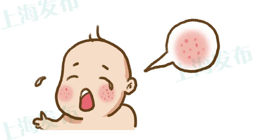 名医 湿疹是免疫功能的混乱 怎样让ta远离你 湿疹 新浪财经 新浪网