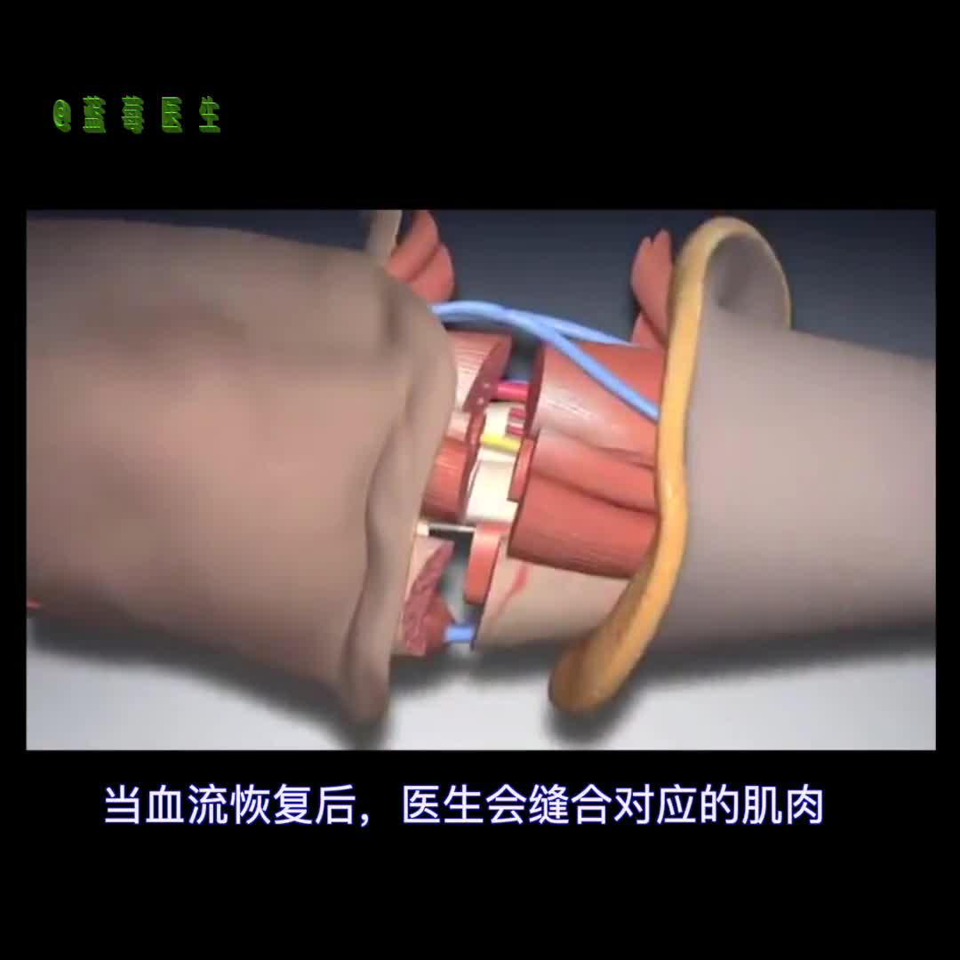 手移植的手术过程