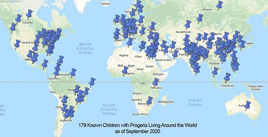 全世界已知的早衰症儿童图片来源:progeria research foundation