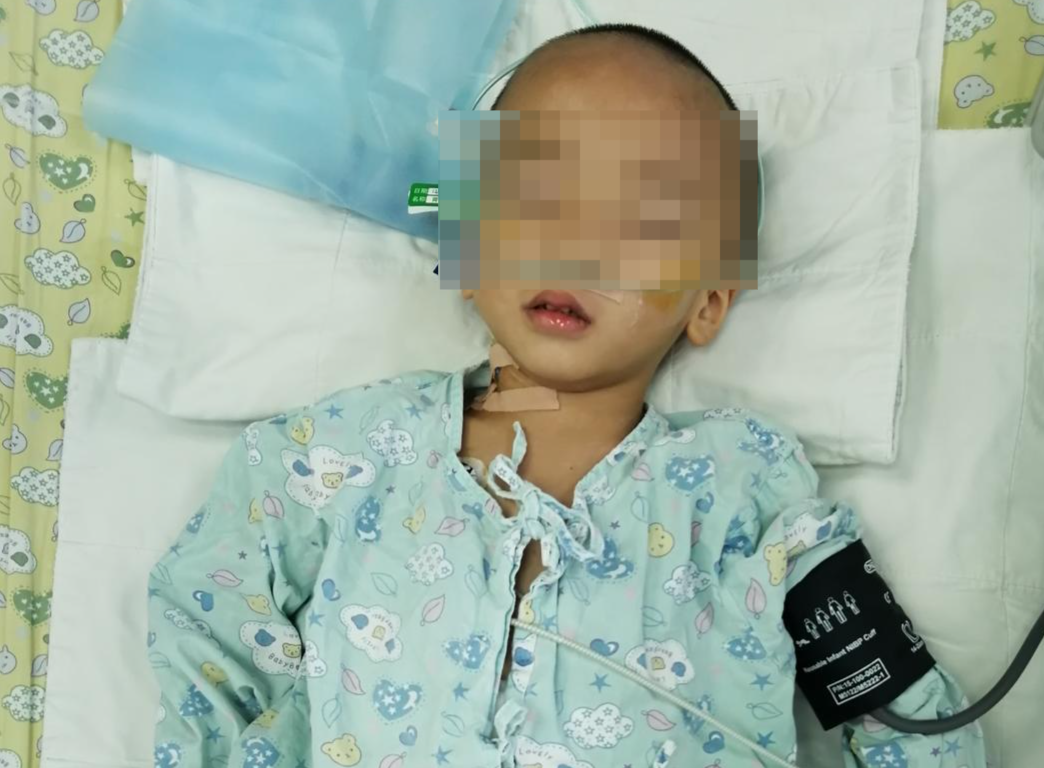 5岁男童肚中"暗藏"巨大神经母细胞瘤 医护6小时联手取出