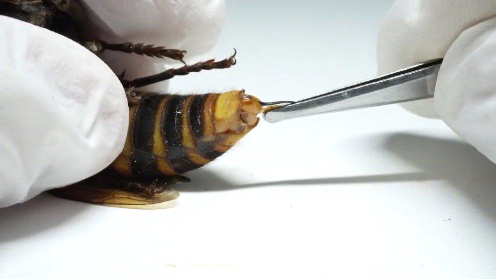 拔除大黄蜂的蛰针 从毒针里流出来的深色液体是毒液