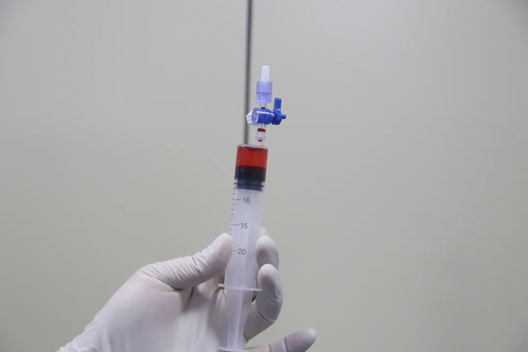 寿光市中医医院成功完成我市首例载药微球栓塞治疗