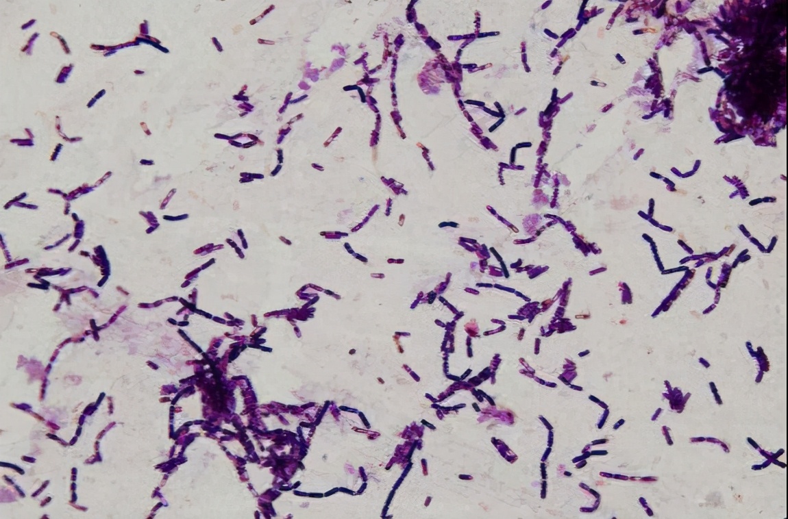 永生|芽孢杆菌|细菌_新浪新闻