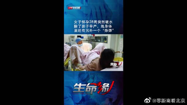 女子怀孕28周突然破水 除了孩子早产 手机新浪网 女子怀孕28周突然破水 除了孩子早产 手机新浪网