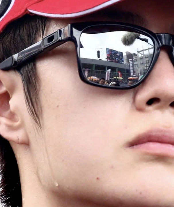 王一博惨遭质疑整容, 超高清面部照片曝光, 网友: 看到了鼻翼切口