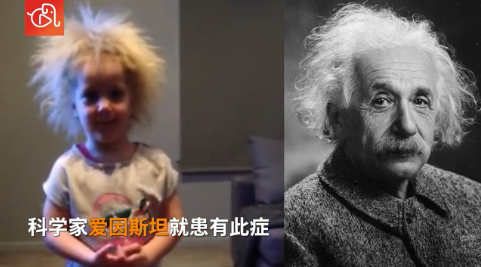 爱因斯坦同款！澳大利亚女孩患“难梳头发综合征”休闲区蓝鸢梦想 - Www.slyday.coM