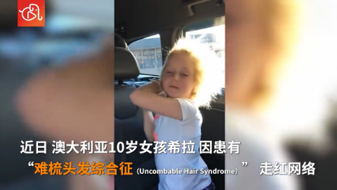 爱因斯坦同款！澳大利亚女孩患“难梳头发综合征”休闲区蓝鸢梦想 - Www.slyday.coM