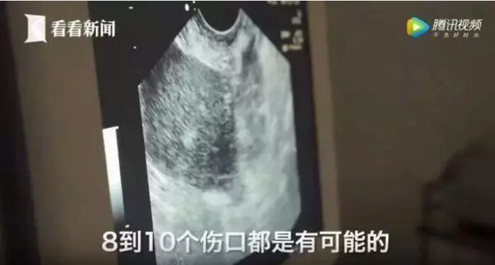 地下捐卵乱象 富人拿钱买生命 女孩以命换金钱 中介大发横财 新浪新闻