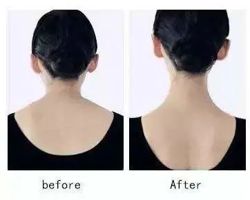 很多人日常的动作都存在过度耸肩和缩脖子的情况,这个时候斜方肌上部