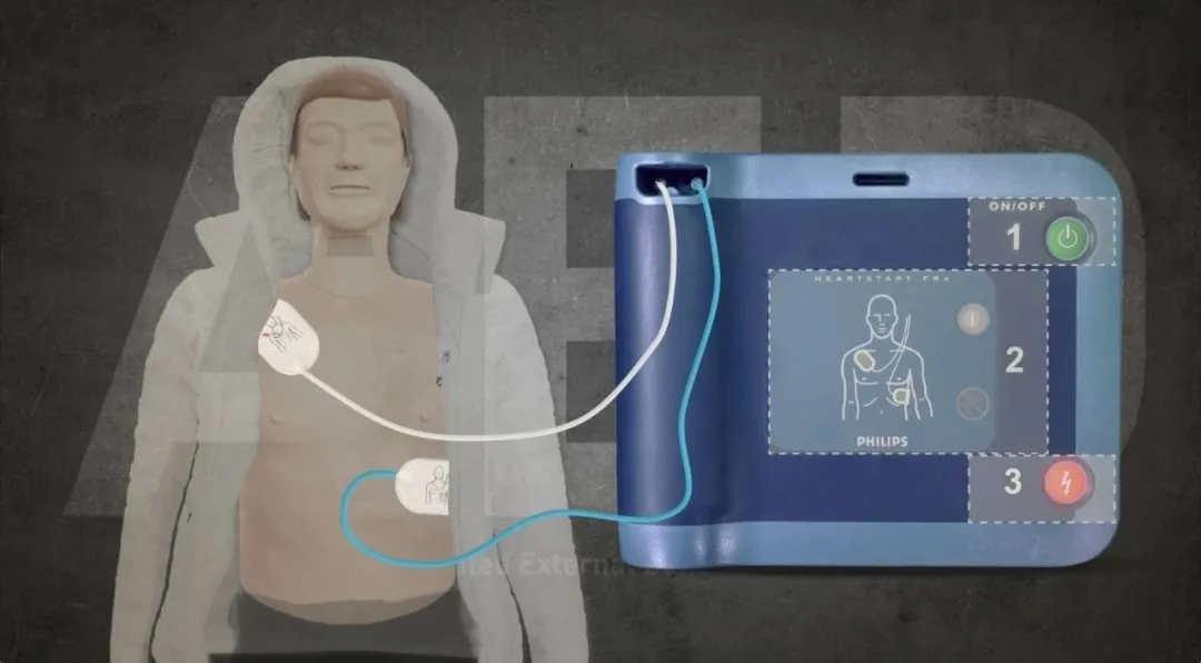 视频|aed 如何拯救濒死的人