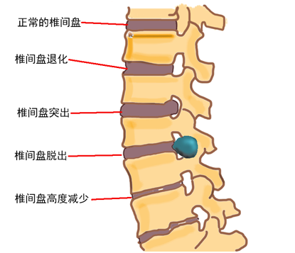 治疗颈椎腰椎病 大连这家中医骨科 不简单 骨科 新浪新闻 治疗颈椎腰椎病 大连这家中医骨科 不简单 骨科 新浪新闻