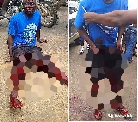 在鸡鸡黑市,他们把从非洲偷来的鸡鸡在美国高价出售|科吉州|黑市|器官