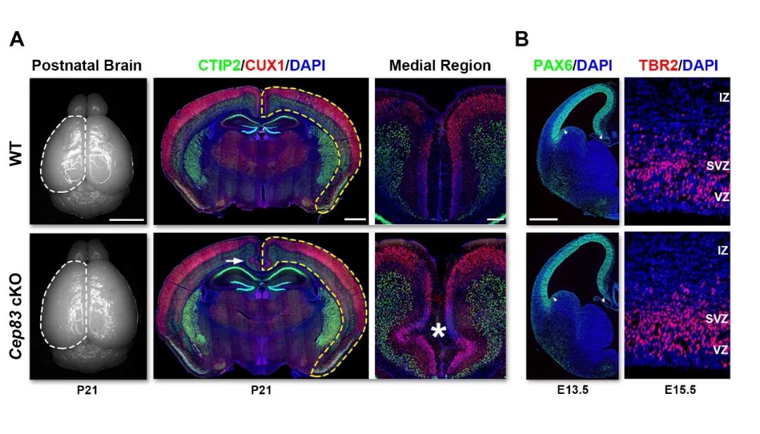 有趣的是,特异性地破坏放射状胶质细胞内中心体的锚定后,小鼠成年后的
