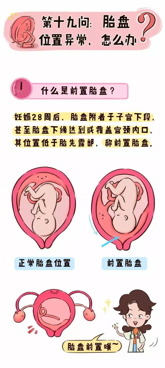 前置胎盘有多可怕孕期阴道反复流血怎么办