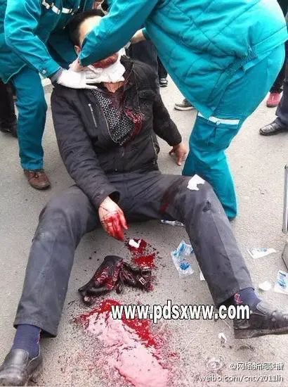 此物割喉已多人中招,一定要提高警惕!