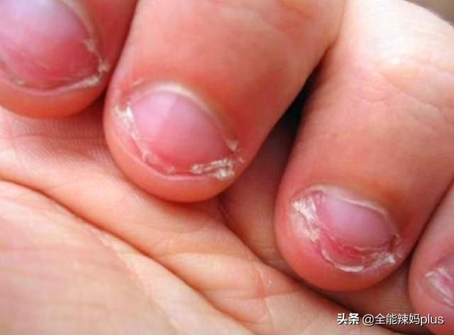 从小爱啃手指的孩子,长大难逃这3种结局,你家孩子中了吗?