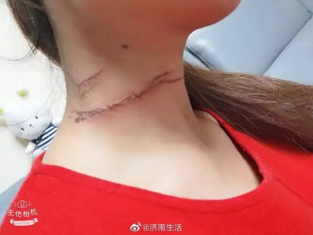 此物割喉已多人中招,一定要提高警惕!