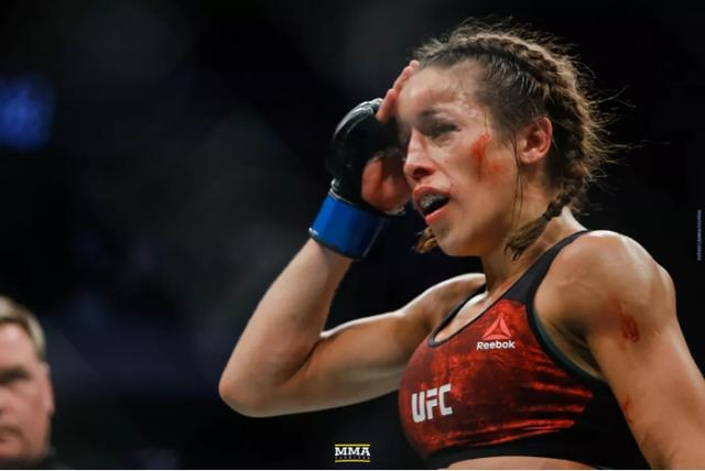 被张伟丽打到失明乔安娜到底伤的有多重