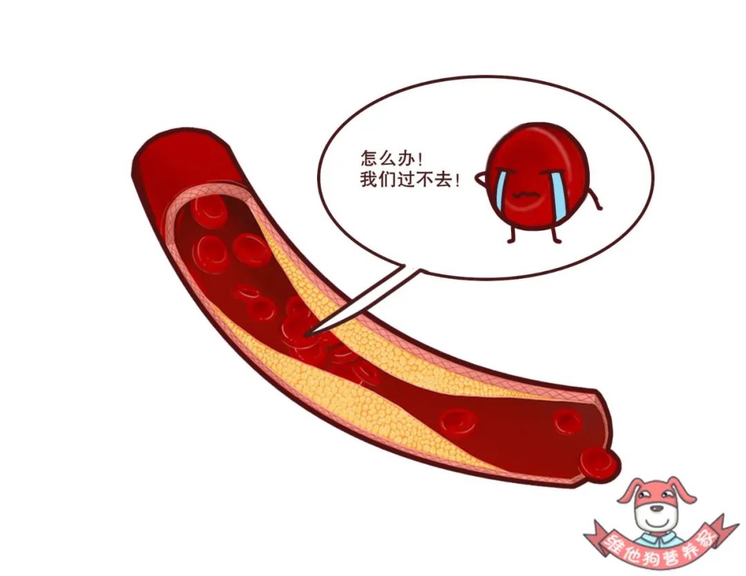 家有高血脂不要慌饮食做好这几点比吃药更管用