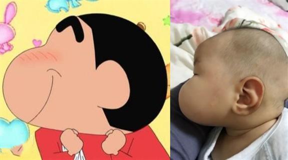 原来"蜡笔小新脸"真实存在,你家孩子是同款吗,网友:动画侧脸