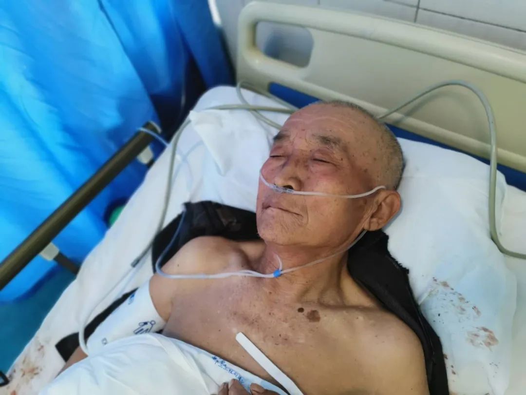 德州丨老人被撞伤在十三局医院治疗急寻家属