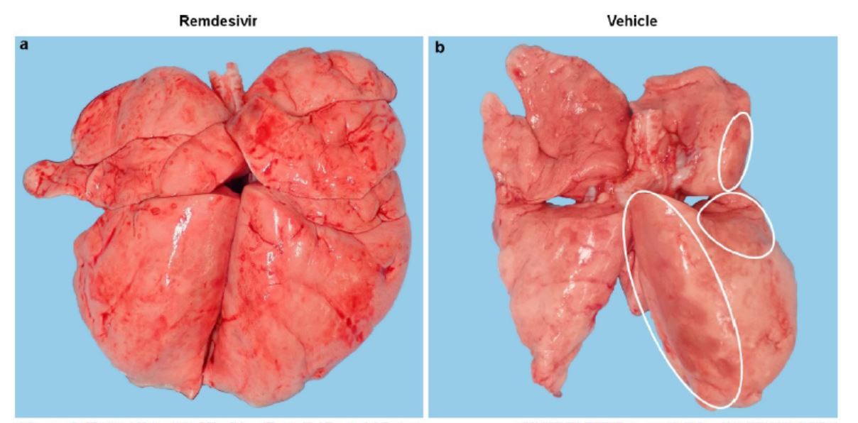 瑞德西韦恒河猴试验支气管病毒量降100倍但未减少排毒